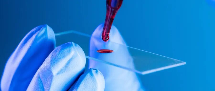 【原創(chuàng)研究】血液制品行業(yè)投研報(bào)告之二:國內(nèi)企業(yè)分離提純工藝仍有較大提升空間